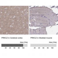 Anti-PRKCZ antibody produced in rabbit