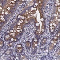 Anti-PRKCZ antibody produced in rabbit