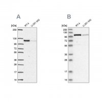 Anti-PRKD2 antibody produced in rabbit 