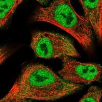 Anti-PRKD2 antibody produced in rabbit 