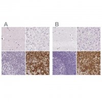 Anti-PRL antibody produced in rabbit 
