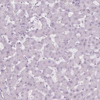 Anti-PRM1 antibody produced in rabbit 