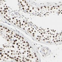 Anti-PRMT3 antibody produced in rabbit HPA007832-100UL