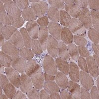 Anti-PROB1 antibody produced in rabbit 