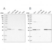 Anti-PROSC antibody produced in rabbit HPA023646-100UL