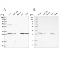 Anti-PROSC antibody produced in rabbit HPA023733-100UL
