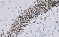 Anti-PROX1 Antibody, clone 1B10 ZooMAb� Rabbit Monoclonal 