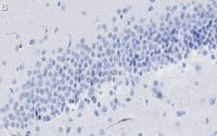 Anti-PROX1 Antibody, clone 1B10 ZooMAb� Rabbit Monoclonal 