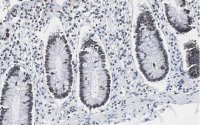 Anti-PRPF19 Antibody, clone 1K10 ZooMAb� Rabbit Monoclonal 