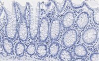 Anti-PRPF19 Antibody, clone 1K10 ZooMAb� Rabbit Monoclonal 