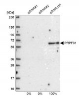 Anti-PRPF31 antibody produced in rabbit 