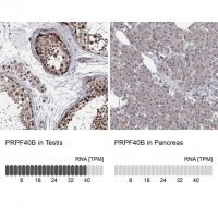 Anti-PRPF40B antibody produced in rabbit 