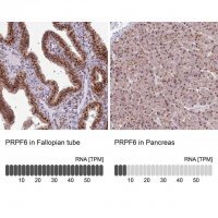 Anti-PRPF6 antibody produced in rabbit 