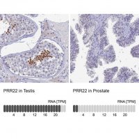 Anti-PRR22 antibody produced in rabbit 
