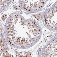Anti-PRRX1 antibody produced in rabbit
