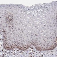 Anti-PRRX1 antibody produced in rabbit