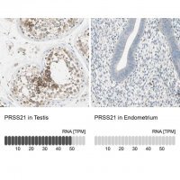 Anti-PRSS21 antibody produced in rabbit