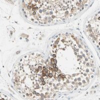 Anti-PRSS21 antibody produced in rabbit