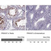 Anti-PRSS37 antibody produced in rabbit 