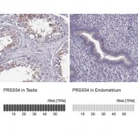 Anti-PRSS54 antibody produced in rabbit 