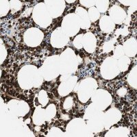 Anti-PRTN3 antibody produced in rabbit