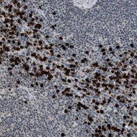 Anti-PRUNE2 antibody produced in rabbit 