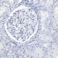 Anti-PSD3 antibody produced in rabbit 