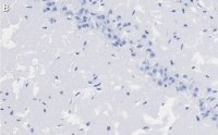 Anti-PSD95 Antibody, clone K28/43 ZooMAb� Mouse Monoclonal 