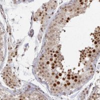 Anti-PSKH1 antibody produced in rabbit