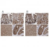 Anti-PSMB1 antibody produced in rabbit