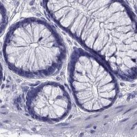 Anti-PSMB11 antibody produced in rabbit