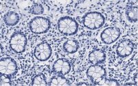 Anti-PSMB2 Antibody, clone 2N18 ZooMAb� Rabbit Monoclonal 