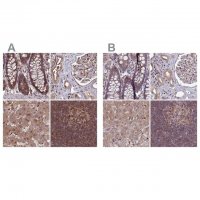 Anti-PSMB8 antibody produced in rabbit HPA046995-100UL