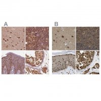 Anti-PSMC5 antibody produced in rabbit 