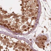 Anti-PSMC5 antibody produced in rabbit 