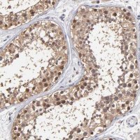 Anti-PSMD10 antibody produced in rabbit 