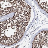 Anti-PSMD12 antibody produced in rabbit