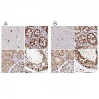 Anti-PSMD7 antibody produced in rabbit 