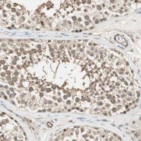 Anti-PSMD8 antibody produced in rabbit HPA006702-100UL