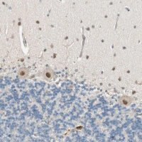 Anti-PSMD8 antibody produced in rabbit HPA006702-100UL