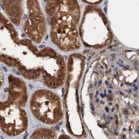 Anti-PSMD9 antibody produced in rabbit 