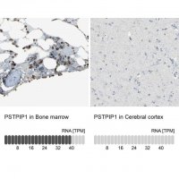 Anti-PSTPIP1 antibody produced in rabbit 