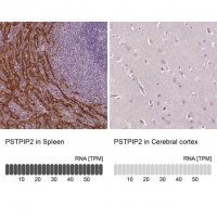 Anti-PSTPIP2 antibody produced in rabbit 