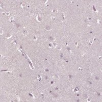 Anti-PSTPIP2 antibody produced in rabbit 