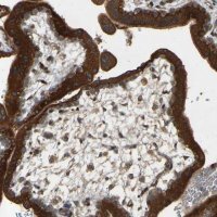 Anti-PTCD1 antibody produced in rabbit 