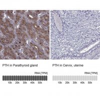 Anti-PTH antibody produced in rabbit 