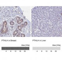 Anti-PTHLH antibody produced in rabbit 