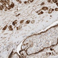 Anti-PTK6 antibody produced in rabbit 