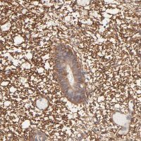 Anti-PTK7 antibody produced in rabbit