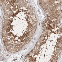 Anti-PTPDC1 antibody produced in rabbit 